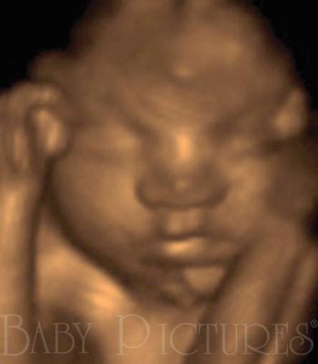 Baby Pictures Before Ultrasound Picture