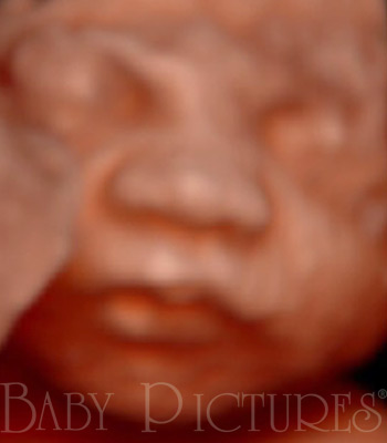 Baby Pictures Before Ultrasound Picture