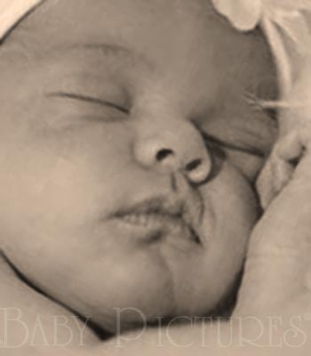 Baby Pictures After Ultrasound Picture