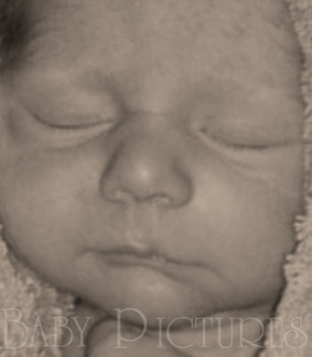 Baby Pictures After Ultrasound Picture