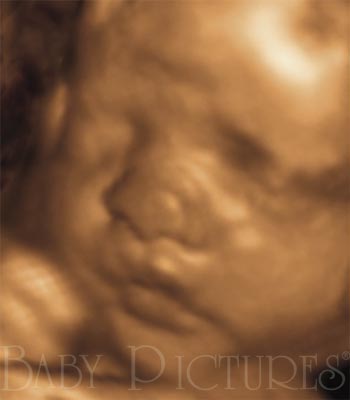 Baby Pictures Before Ultrasound Picture