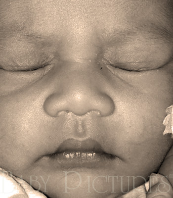 Baby Pictures After Ultrasound Picture