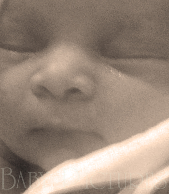 Baby Pictures After Ultrasound Picture