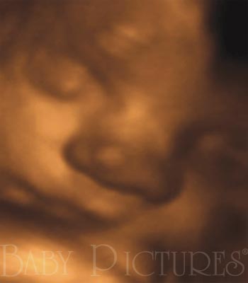 Baby Pictures Before Ultrasound Picture